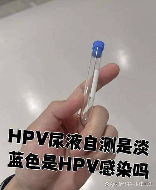 女性怎么知道自己感染了hpv