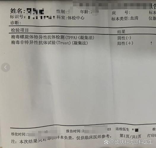 正常人梅毒滴度是多少