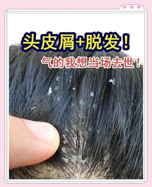 理发店毁头发能赔钱吗