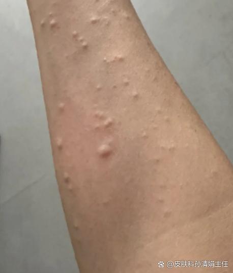 长一片密密麻麻小颗粒