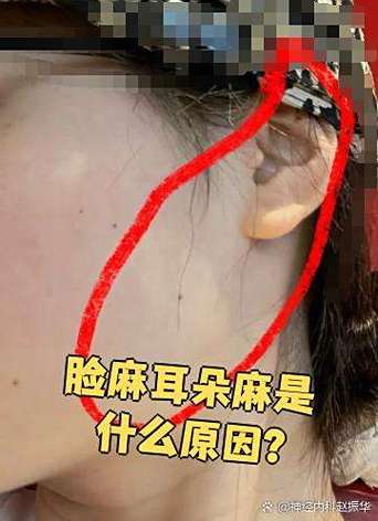 一只耳朵麻木没有知觉缩略图