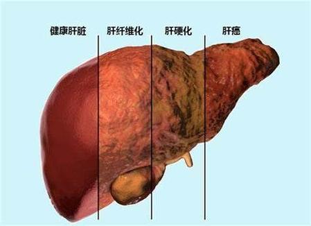 乙肝携带者会传染人吗