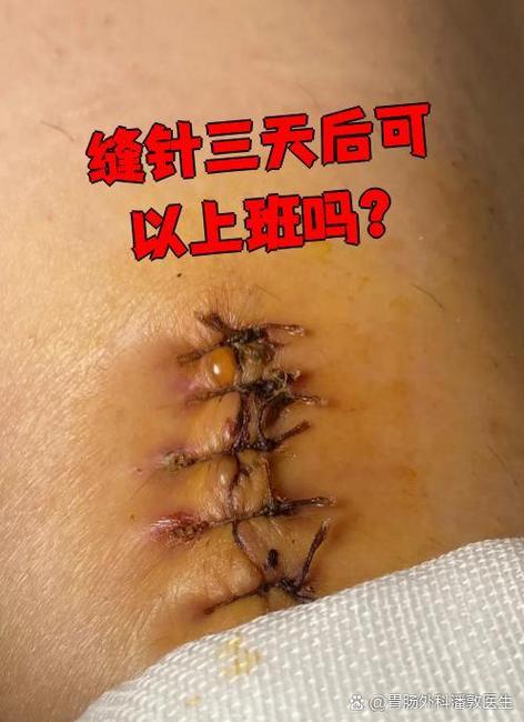 老式缝纫机针价格截图
