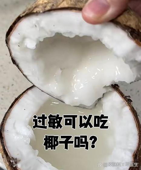 椰子容易过敏吗