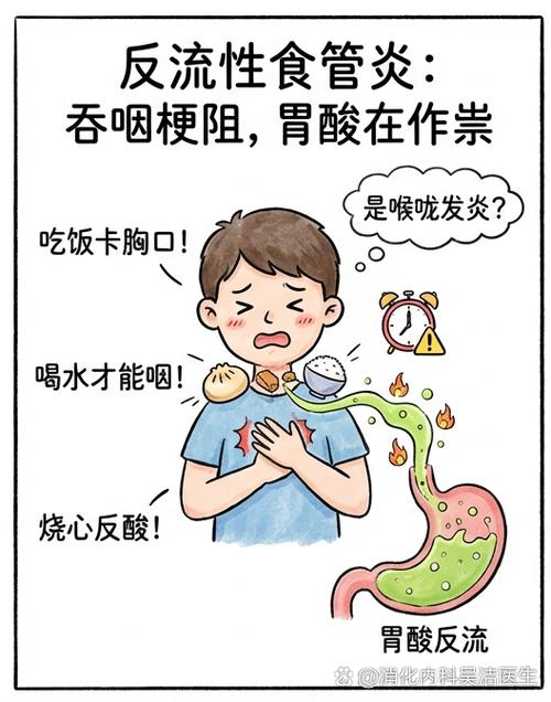 吃饭食物老是卡在胸口