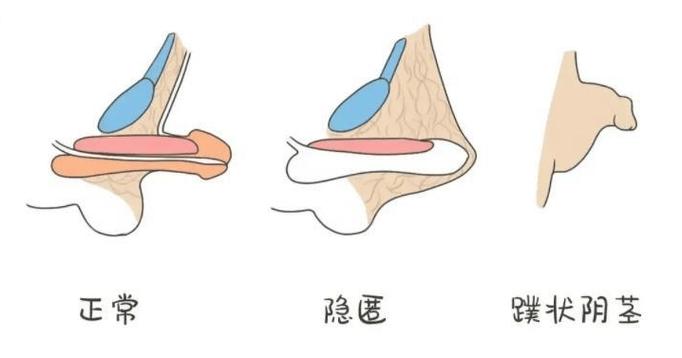 为什么有些软件删不掉