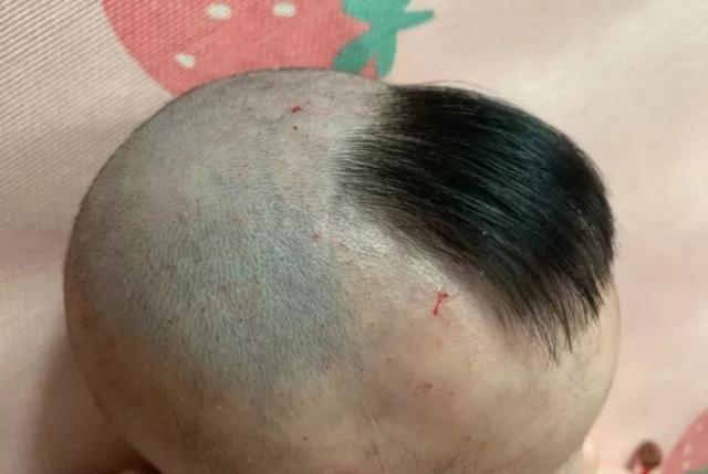 宝宝头上有圆光圈