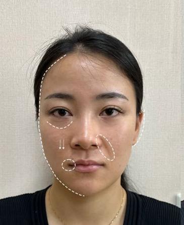 美颜能改变五官吗