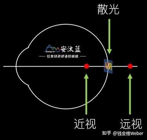 散光折合近视计算器
