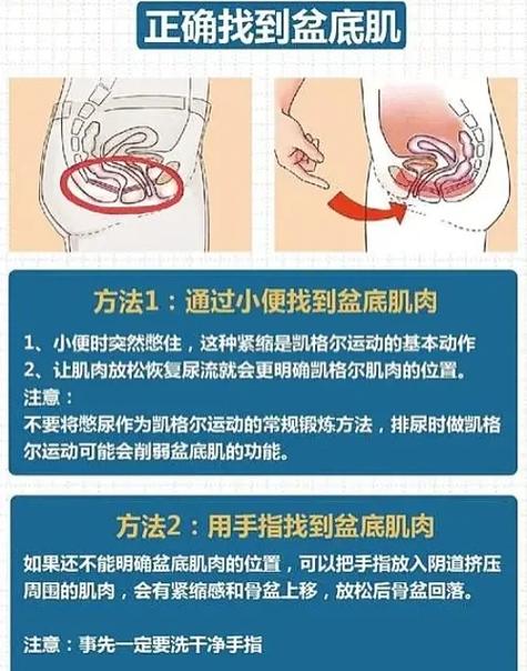 盆底肌怎么恢复训练