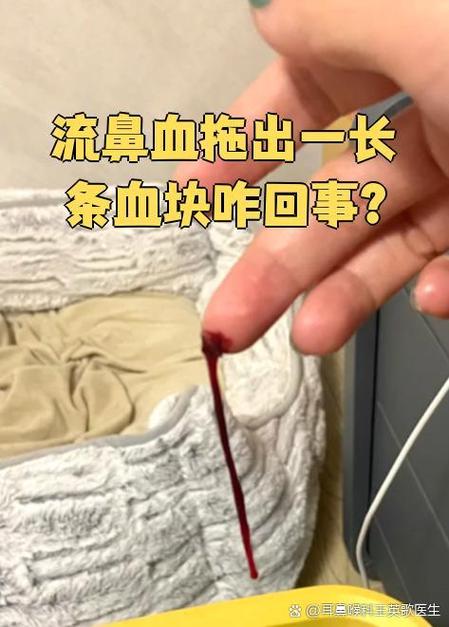 好好的突然流鼻血怎么回事