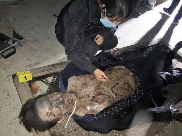 法医尸检图片