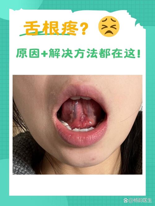 舌头像挫的感觉是怎么回事?