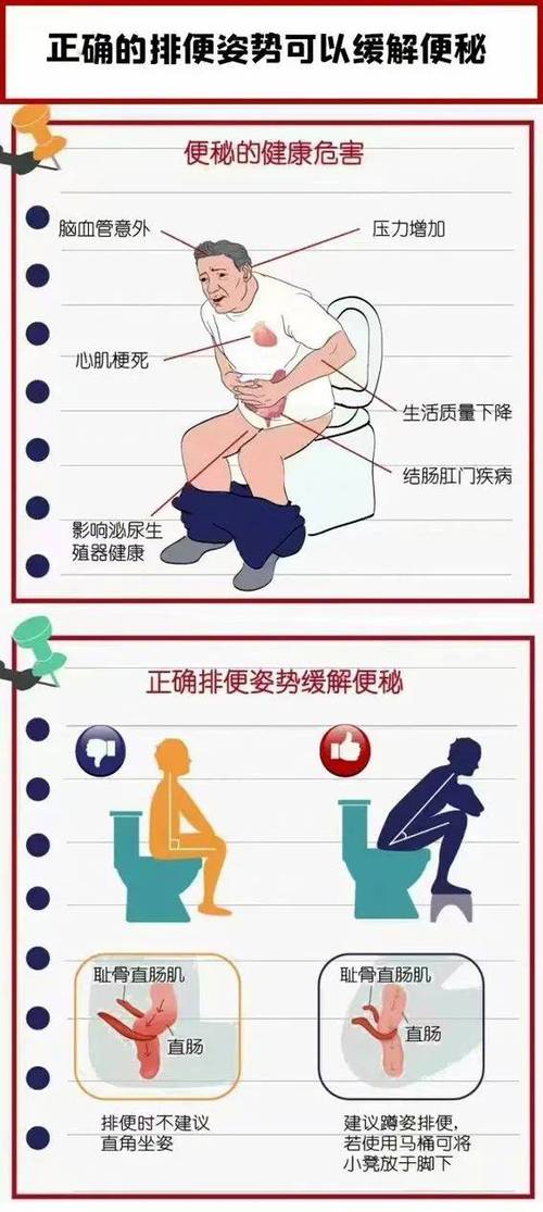 解决便秘最快的方法缩略图