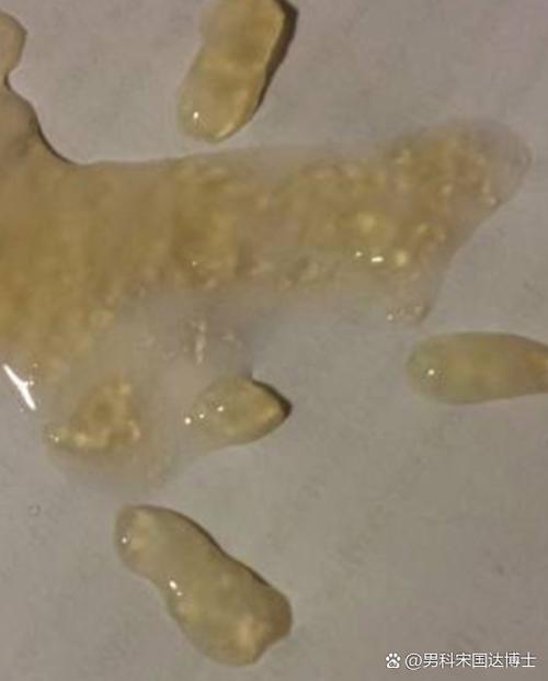 果冻精能生育吗