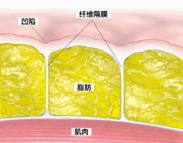 脂肪爆破原理是什么