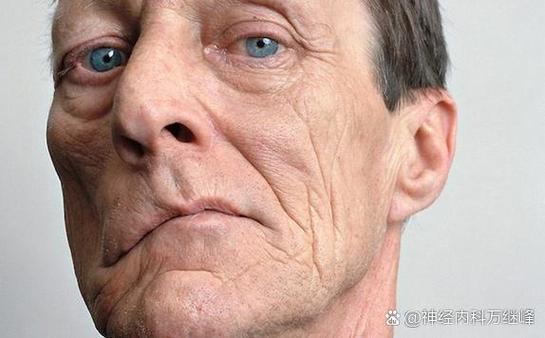 面部肌肉僵硬图标