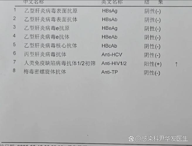 高危10天能不能检查出hiv