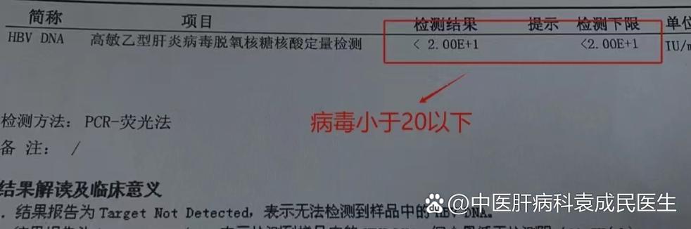 乙肝病毒dna小于20什么意思