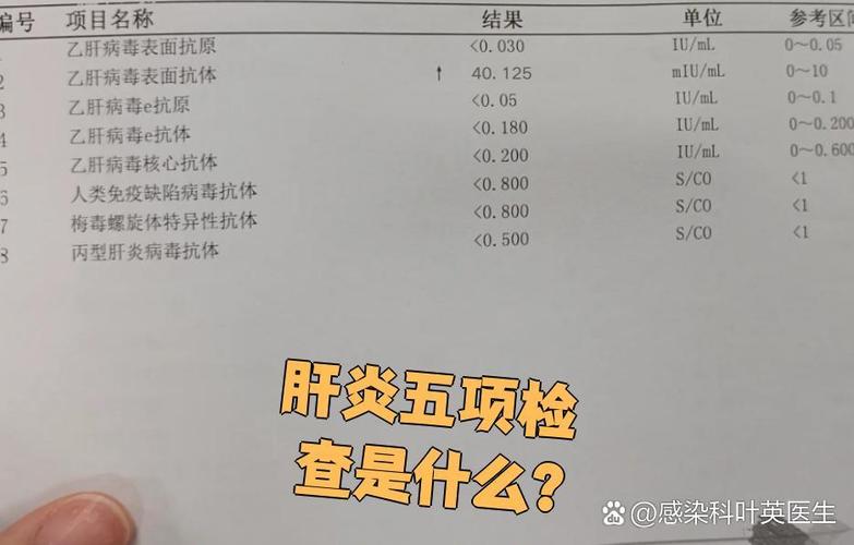 甲乙肝检查叫什么项目