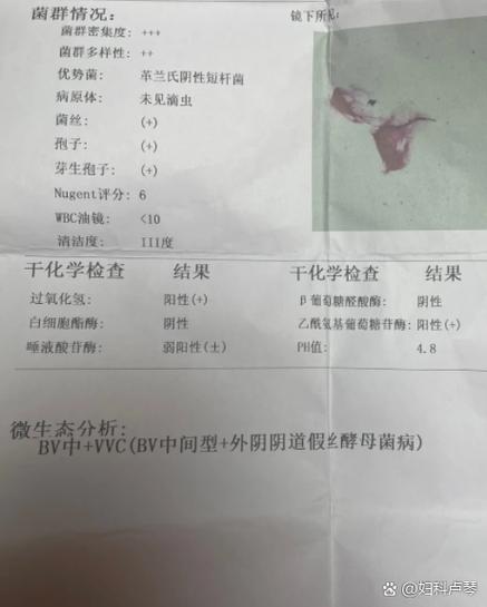 妇科查出有真菌孢子是什么病