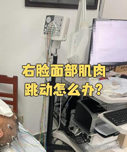 右边脸肌肉时不时跳动