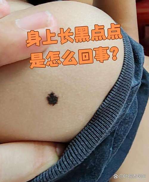 七彩身上长黑点怎么治图标
