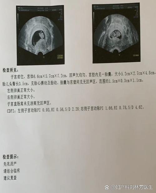 50天没孕囊还只有暗区截图
