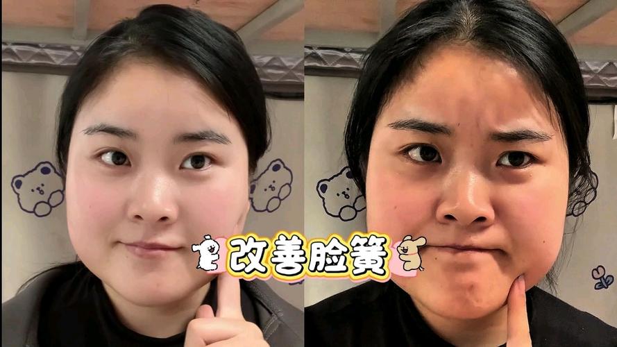 我的脸比较黄怎么改善