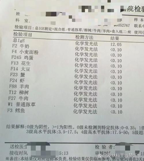 ige检测结果参考值