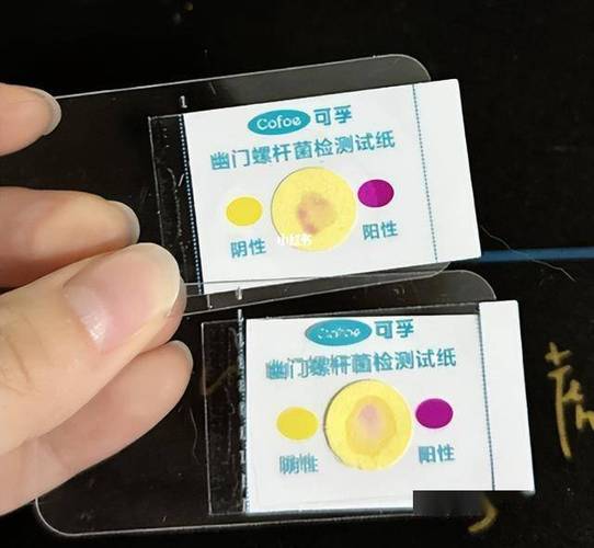 幽门螺旋杆菌试纸红了