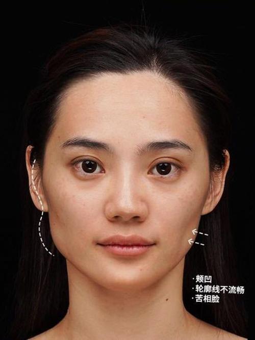 打玻尿酸的脸老了会怎么样
