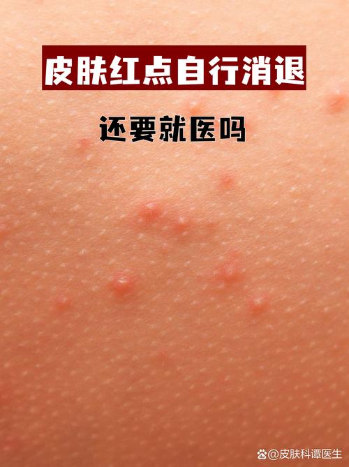 蓝莓过敏的10大表现截图