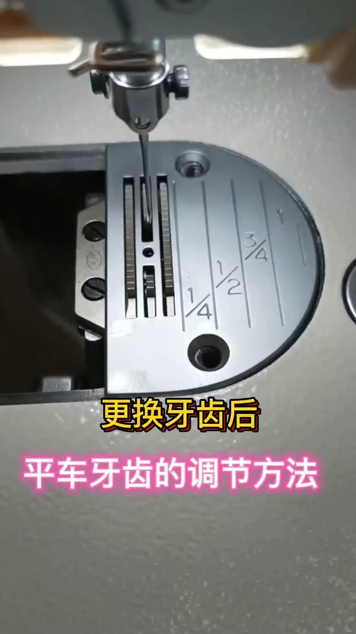 平车牙齿一般是前高后低吗