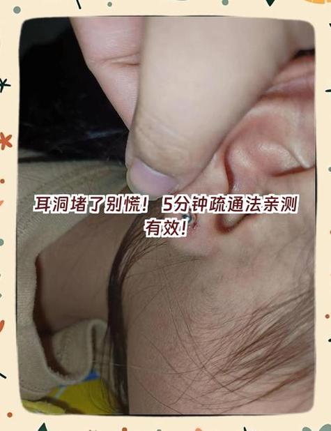 耳洞堵了怎么通开
