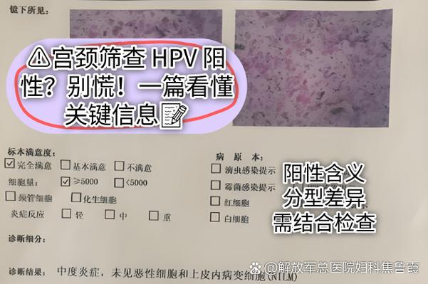 hpv44阳性会传染家人吗截图