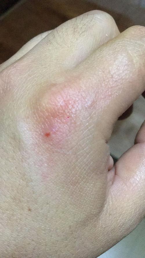 被猫爪子刮一点表皮