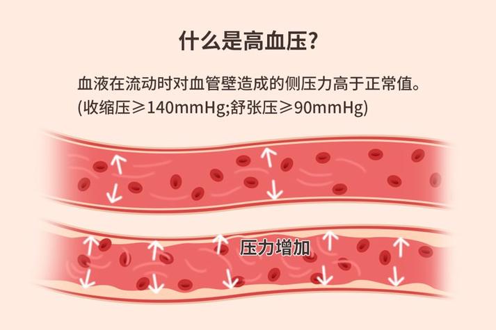 加压反应室