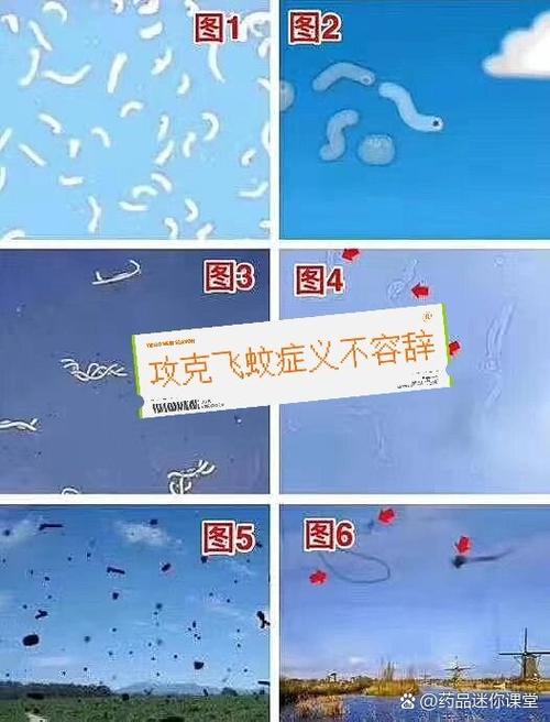 眼前漂浮物飞蚊症应对方法