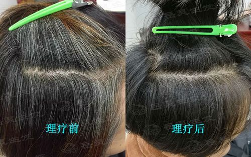 白发变黑最简单的方法游戏截图