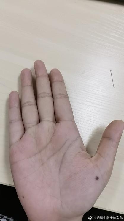 手机点屏幕反应迟钝是怎么回事