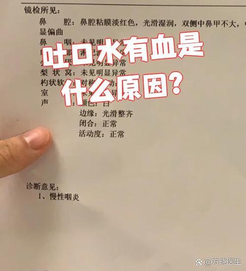 口水带血要警惕三种病缩略图