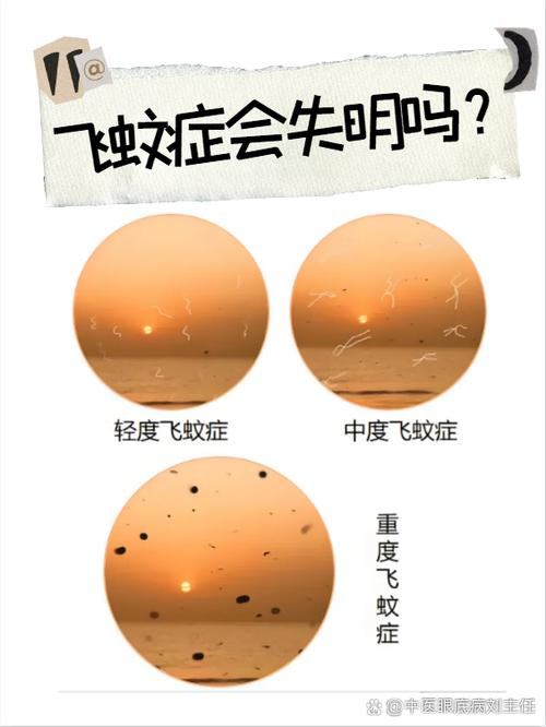 飞蚊症自愈方法图标