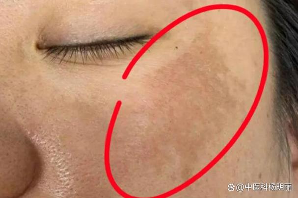 拍照脸上好多斑照镜子没有