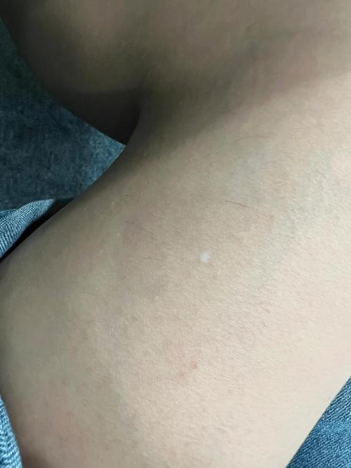 橙子里有小白点是怎么回事儿