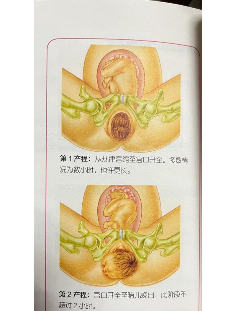 宫口全开截图
