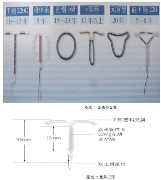 曼月乐环的图片