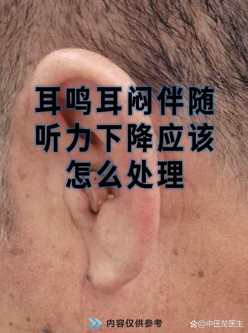 耳机一晃动就暂停图标