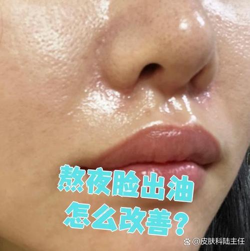 脸上出油多如何改善