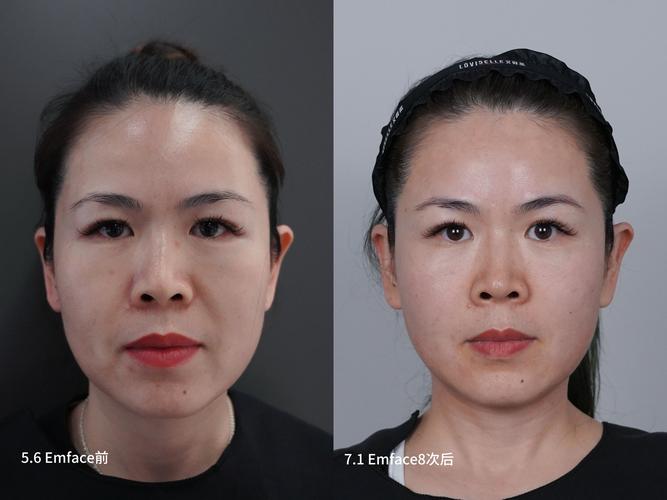 onlyfaceAPP下载截图